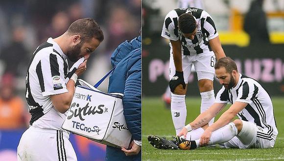 Gonzalo Higuaín de malas: Juventus gana, pero sale lesionado a los minutos