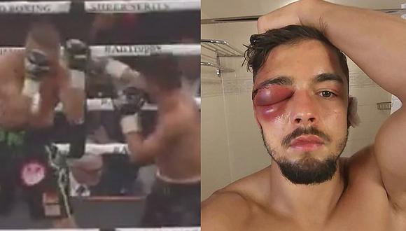 La increíble lesión en el ojo de un boxeador por un título del mundo