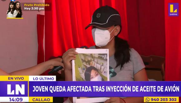 Joven queda afectada tras inyección de aceite de avión. Foto: Latina