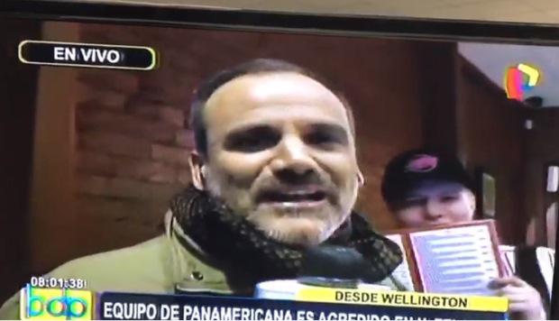 Omar Ruiz de Somocurcio protagonista de radical cambio físico tras implante capilar| VIDEO (Foto: Captura)