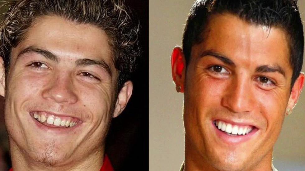 Cristiano Ronaldo | Las cinco operaciones que se hizo CR7 tras su paso por Manchester United y Real Madrid | VIDEOS 