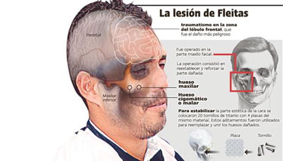 Leandro Fleitas evolucionó bien de operación y le dan de alta el próximo martes