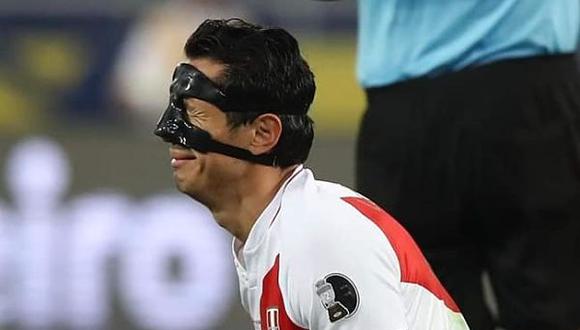 Gianluca Lapadula mostró cómo quedó su nariz tras en partido Perú vs. Colombia. (Foto: EFE)
