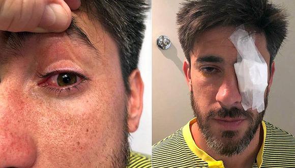 Futbolista de Boca tiene que ser operado tras ataque de hinchas de River