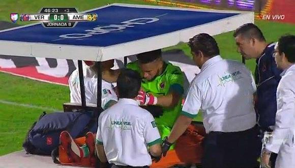 Liga MX: Pedro Gallese se lesionó y salió llorando del campo