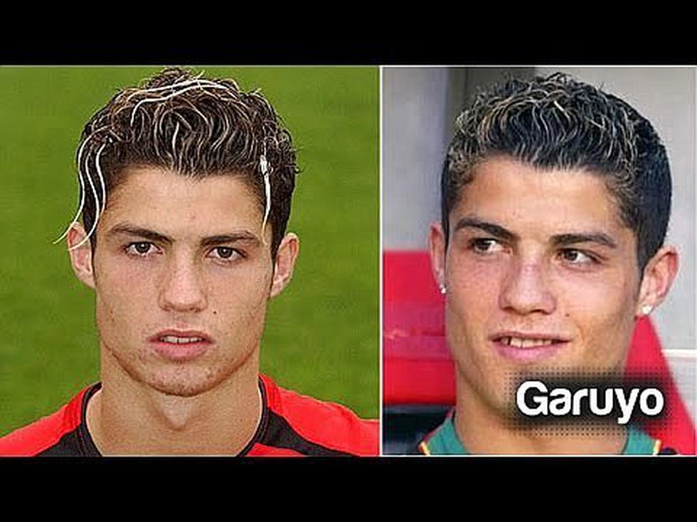 Cristiano Ronaldo | Las cinco operaciones que se hizo CR7 tras su paso por Manchester United y Real Madrid | VIDEOS 