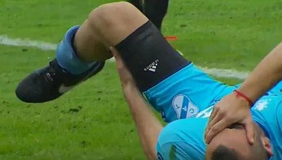 YouTube: Christian Chimino sufre terrible lesión en torneo argentino
