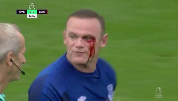 Wayne Rooney: el terrible codazo que puso en peligro su ojo [VIDEO]