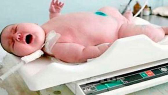 Viral: el bebé más grande de la historia pesa 18 kilos y nació en Australia. FOTO: GEC