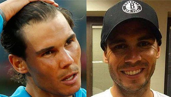 Rafael Nadal: se sometió a una rigurosa operación