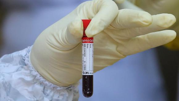 Según un estudio las personas del grupo sanguíneo A serían más propensas a contraer el COVID-19.