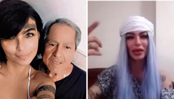La modelo Angie Jibaja fue baleada por  Ricardo Márquez a inicios de abril. (Captura de pantalla / América TV).