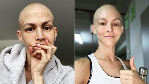 Anahí de Cárdenas reporta su actual estado de salud tras continuar con sus quimioterapias. (Foto: @anahidec)