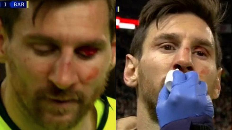 Lionel Messi terminó con un corte en la cara tras choque con Smalling | FOTOS + VIDEO