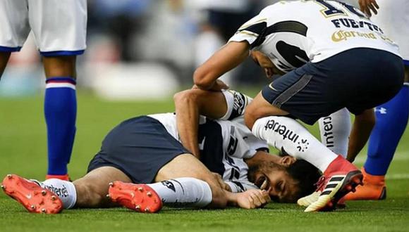 La espeluznante lesión en la Liga MX que ha dado la vuelta al mundo