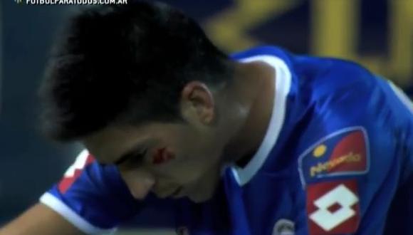 Torneo Argentino: Mira la reacción del árbitro sobre el codazo a un jugador de Godoy Cruz [VIDEO]