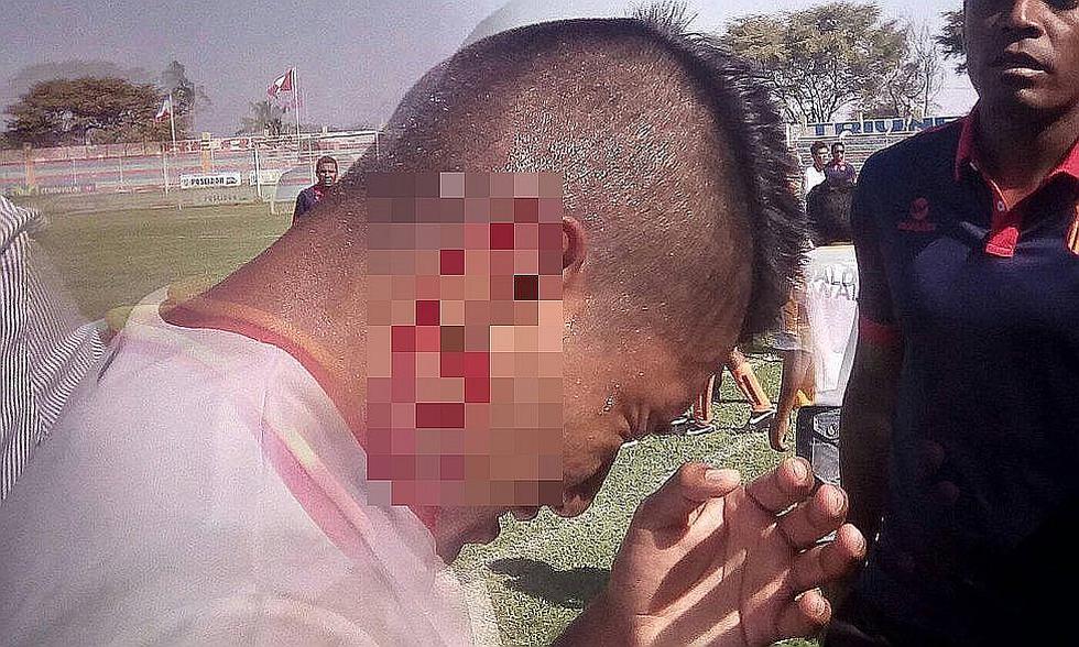 Un partido de Copa Perú terminó nuevamente en bronca [FOTOS]