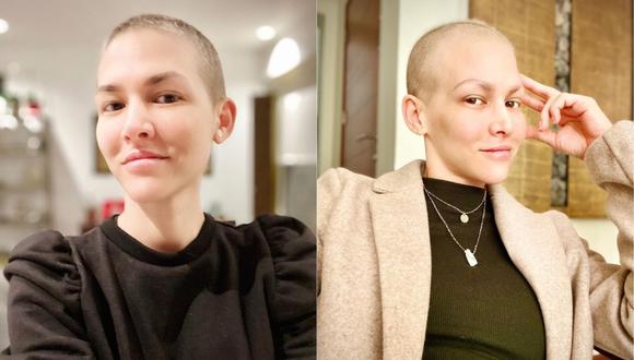 Anahí de Cárdenas se reinventa tras terminar con su quimioterapia. (Foto: @anahidec)