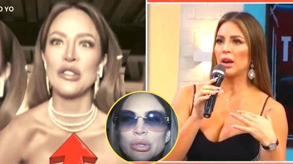 Sheyla Rojas: Informe sobre su parálisis